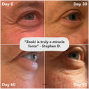 Zooki. Collagène 11000mg. Avant / après à 30, 60 et 90 jours.